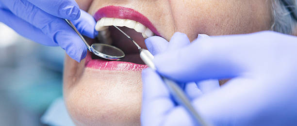 Best Dentist for Tooth Abscess  in Frederick, OK